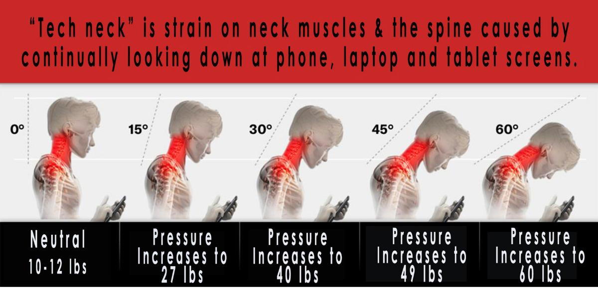 7 Times Bad Posture Caused Your Headaches & Neck Pain - Orthopedic