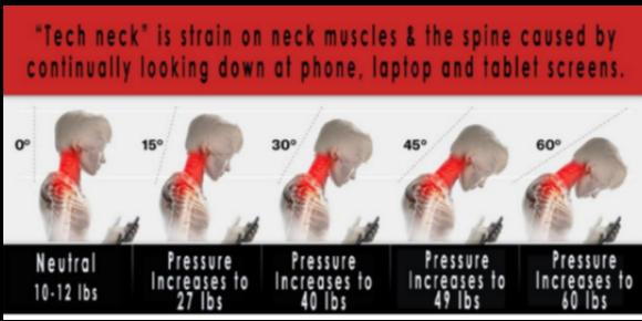 Diagram of a person looking at a phone in five angles, illustrating neck strain. Text highlights pressure increase from 10 to 60 lbs.