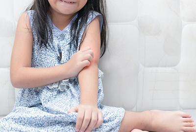 Young girl having a skin allergy scratching her arms