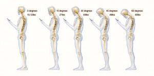 Poor posture linked to decreased lifespan.