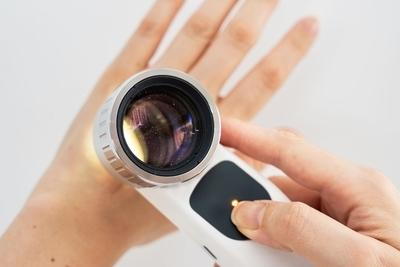 Illustration of Dermatoscopes