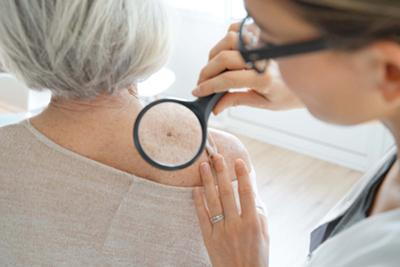 Senior woman undergoing mole evaluation by dermatologist