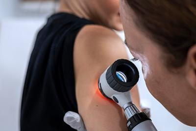 Doctor-examines-skin-mole-on-arm-closely