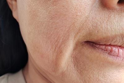 Wrinkles in womans face.