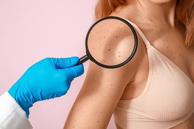Female patient receiving a skin examination by a dermatologist