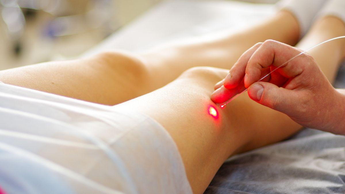 Is Laser Treatment Effective for Arthritis?