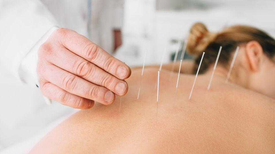 Acupuncture Points for Fertility and Emotional Well-Being