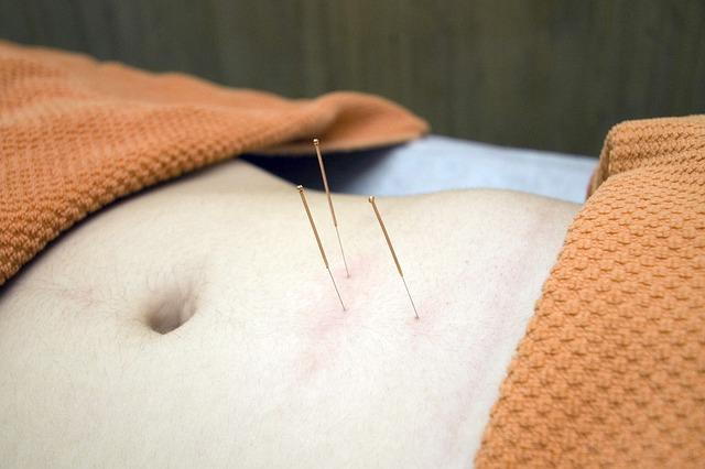 Acupuncture for Treating Lupus &amp; Fatigue