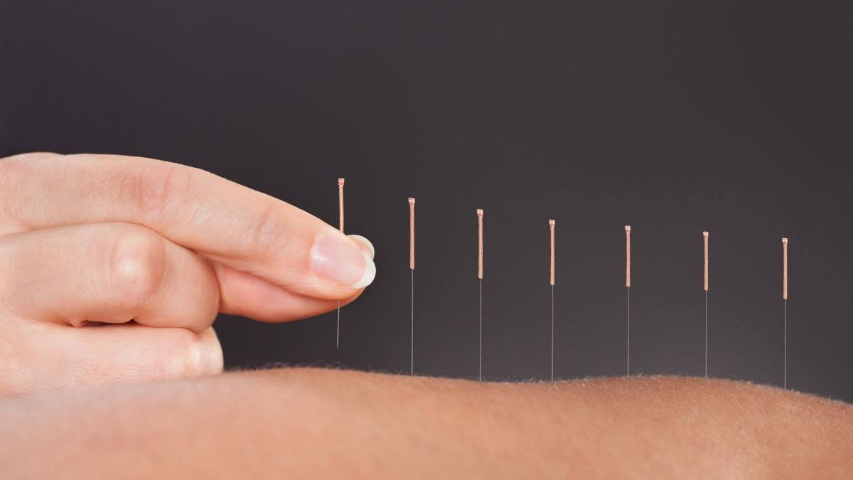 How Does Acupuncture Work for Pain?