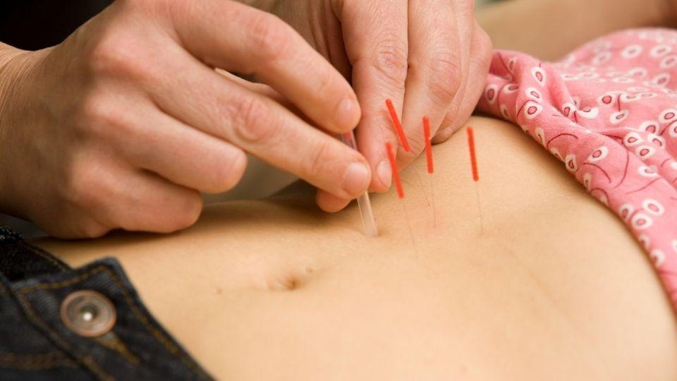 How Can Acupuncture Help You Get Pregnant?