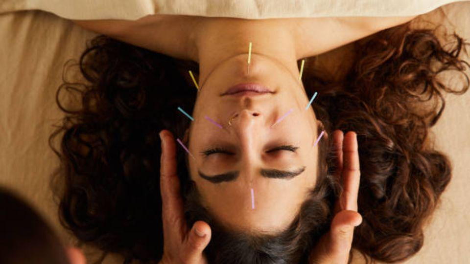 Getting Acupuncture for the First Time? Here's What You Need to Know
