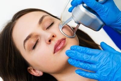 Laser Resurfacing in a face of beautiful woman on clinic.