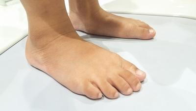 Closed-up-image-of-flat-feet-condition-in-white-floor.