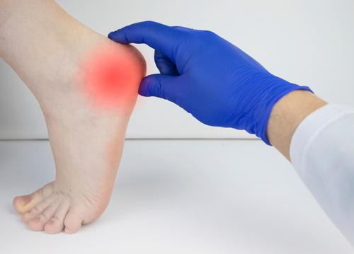 A podiatrist examining a patient's foot to assess heel pain.