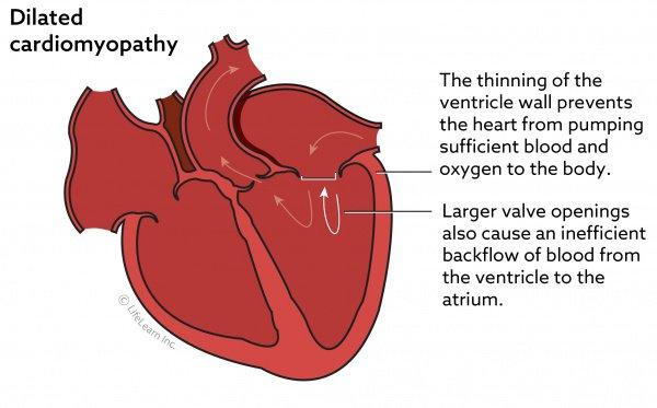 Dilated cardiomyopathy shop in golden retrievers