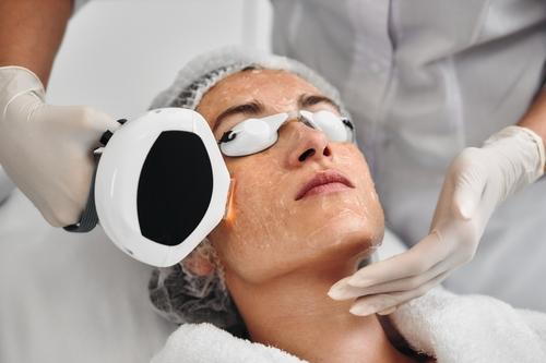 A female client receiving IPL treatment to improve skin tone and clarity.