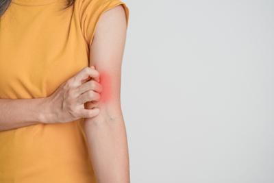 Woman-with-Skin-Rashes