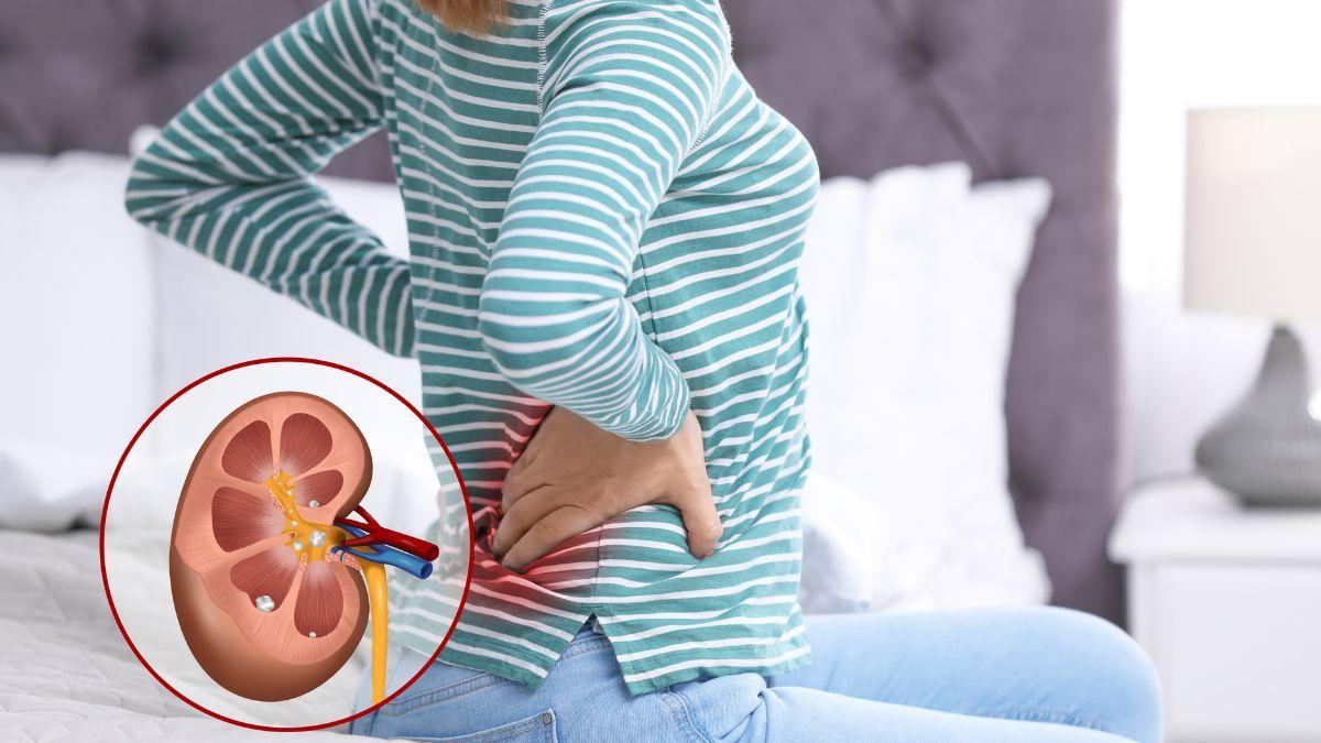 How to Tell the Difference Between Lower Back Pain and Kidney Pain?