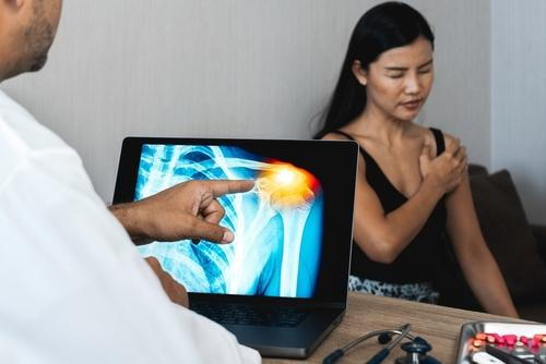 Chiropractor examines X-ray of a female patient with rotator cuff injury