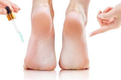 Illustration of drop foot condition on a person