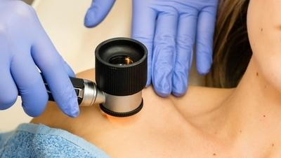 Doctor use magnifying glass to check the condition of the skin.