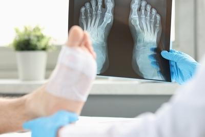 Fractured foot with x-ray and the doctor