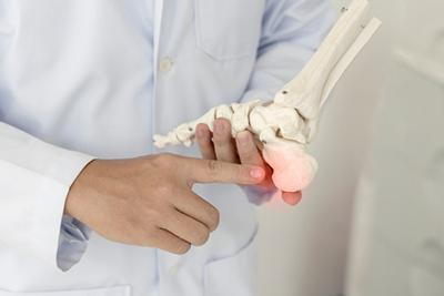 Medical professional using foot model to explain plantar fascia inflammation.