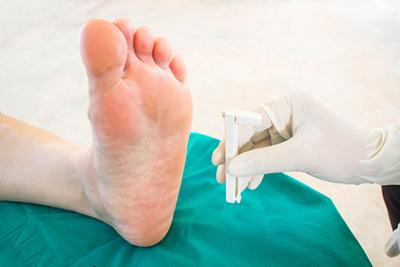 Doctor checking the diabetic foot condition