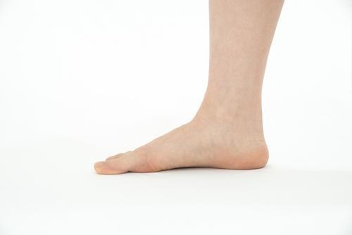 A woman standing to show flat feet against a white background.
