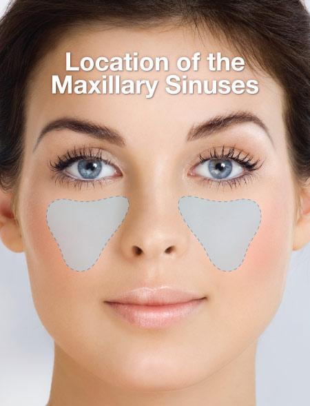 Location of Maxillary Sinuses