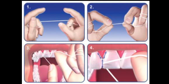 Flossing Flossing Technique Bleeding Gums Healthy Gums Wax Floss