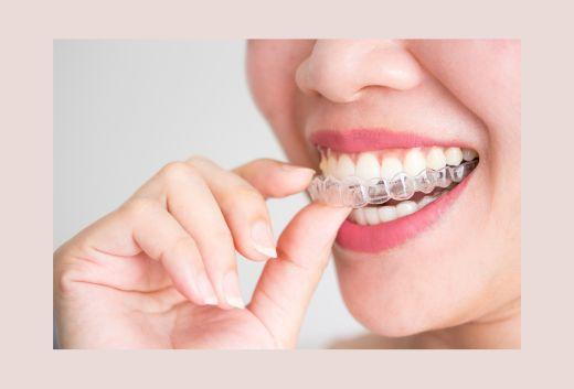 Are braces better than Invisalign?