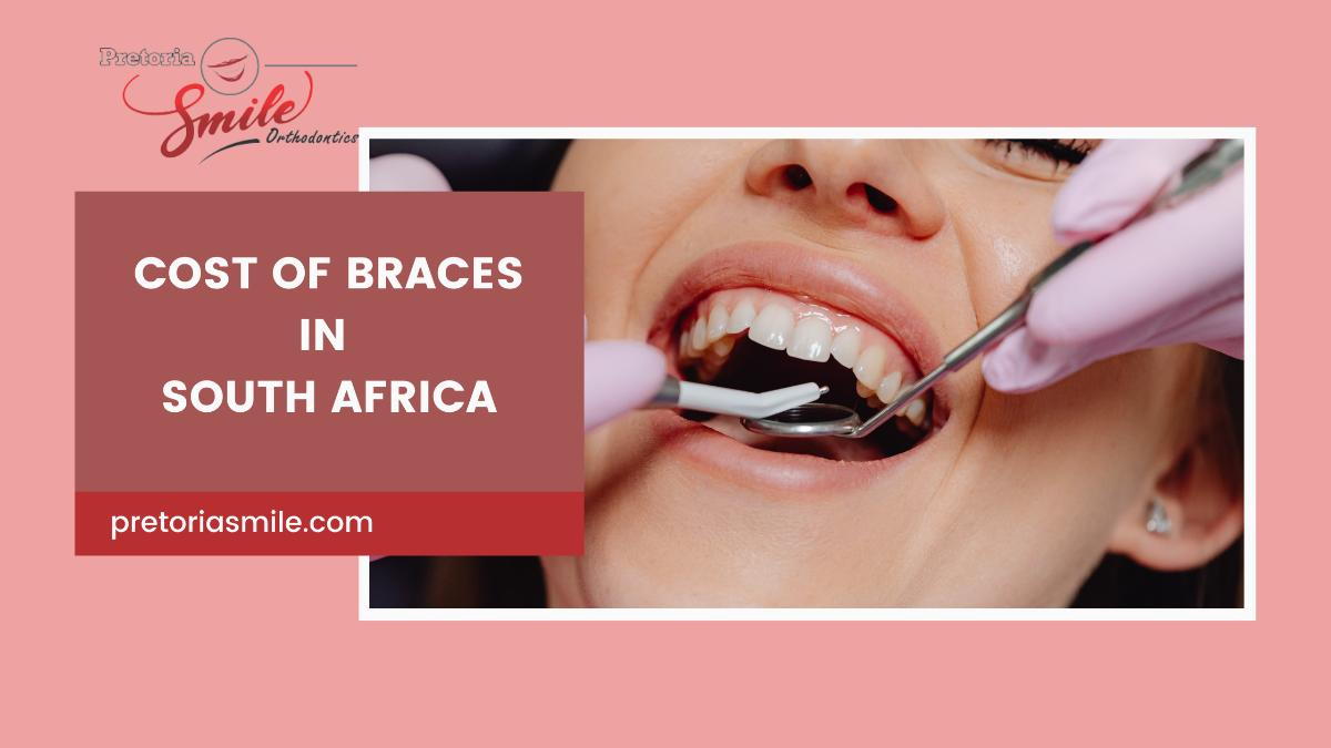 2024 Cost of Braces in South Africa