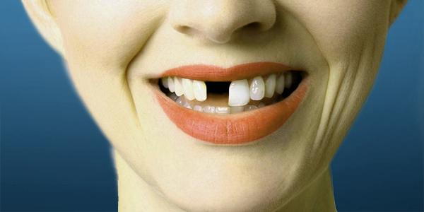 Bad Teeth Health Problems 3091