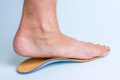 Custom orthotic fitting for flat-footed man