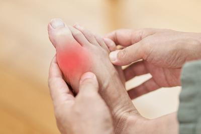 Illustration of gout pain on foot in red