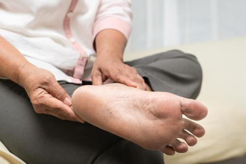 Senior woman with diabetic foot condition