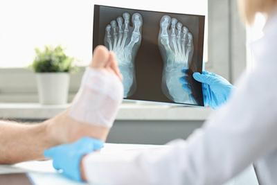Doctor evaluating foot injury using physical exam and imaging results