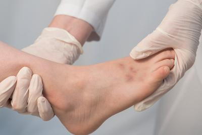 Doctor checking the foot condition of patient