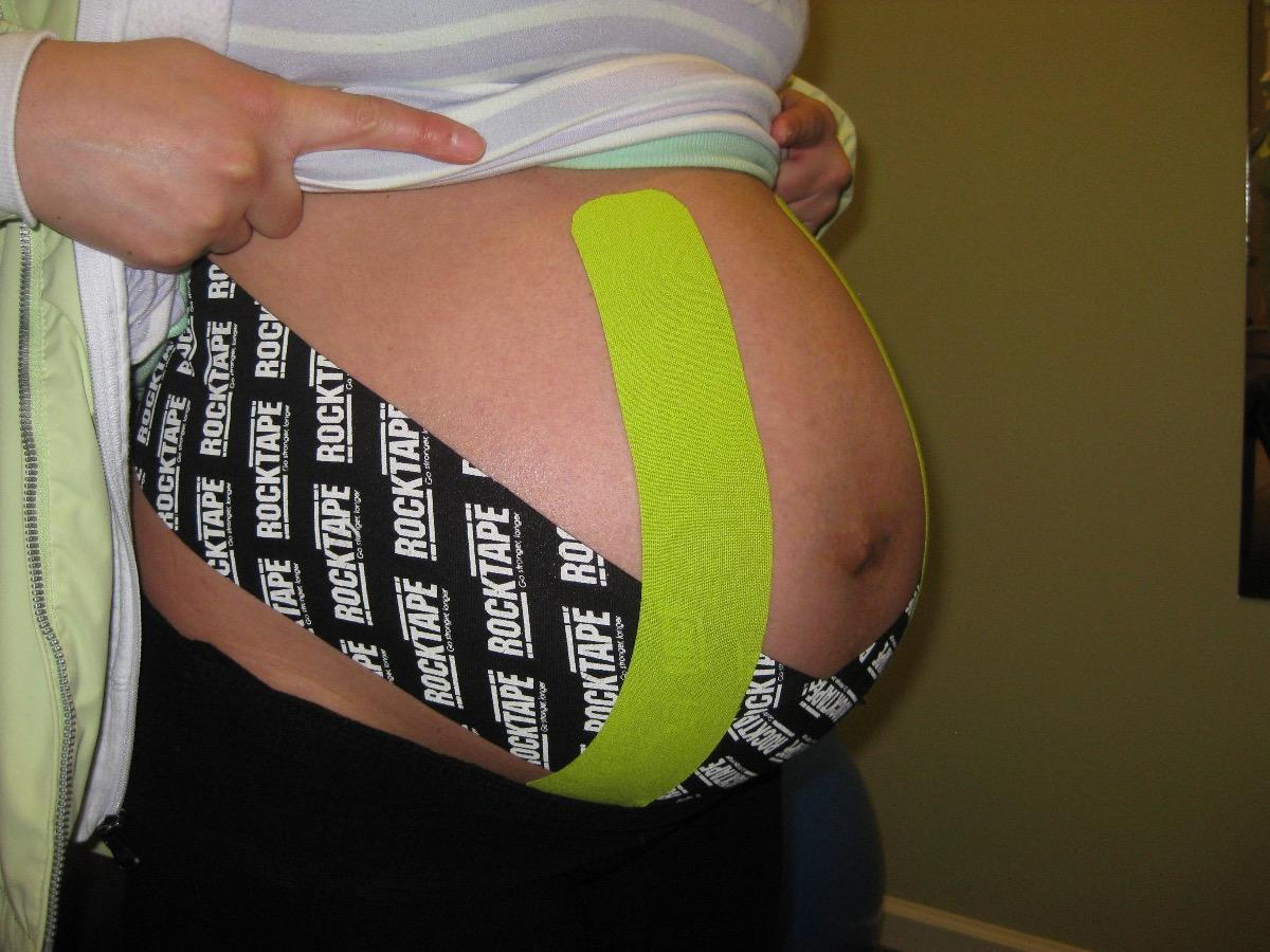Kinesiology Taping for Pregnancy Support