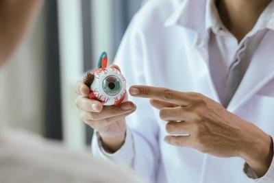 Doctor showing a model with Cataracts condition
