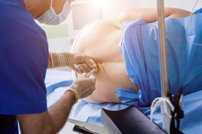 Epidural-Anesthesia-Before-Surgery