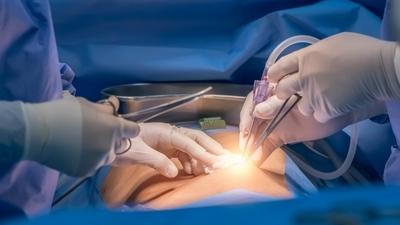 Close-up-of-surgery-with-doctors'-hands-and-tools