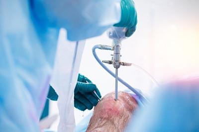 Minimally invasive surgery to repair knee ligaments in a man