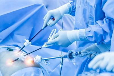 Surgeon performing minimally invasive surgery and highlighting precise area for tissue removal