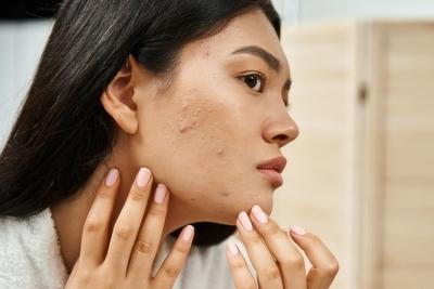 Close-up of woman checking acne on her cheek