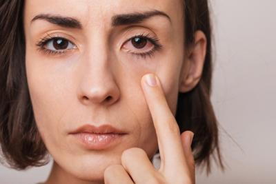 Contact-Lens-Related-Dry-Eye-Symptoms-in-Woman