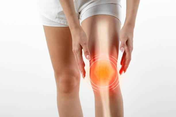 Medical illustration of a knee having a ligament tear