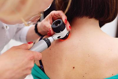 Doctor examining the patient skin on clinic
