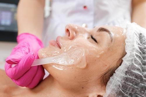 A female client receiving a chemical peel treatment for skin exfoliation and rejuvenation.
